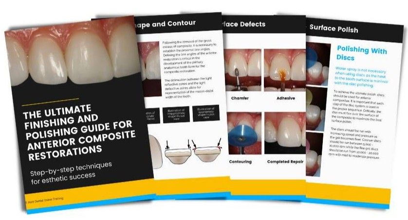 Zirconia Bridge Technique  Conservative Esthetic Tooth Replacement